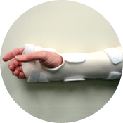Carpal Tunnel Splint with the MCP joints included Carpal Tunnel Splint with the MCP joints included