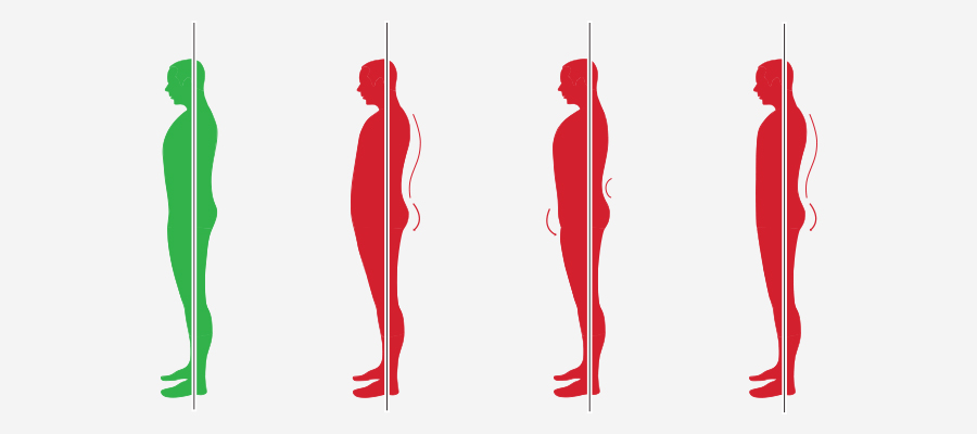 Posture types including, ideal posture and non ideal posture types