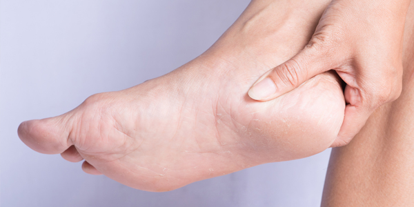 photograph of a woman holding her heel due to heel pain