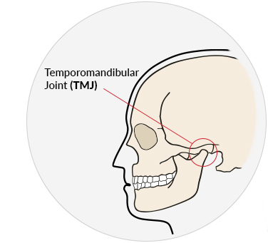 medical illustration of the temporomandibular joint TMJ